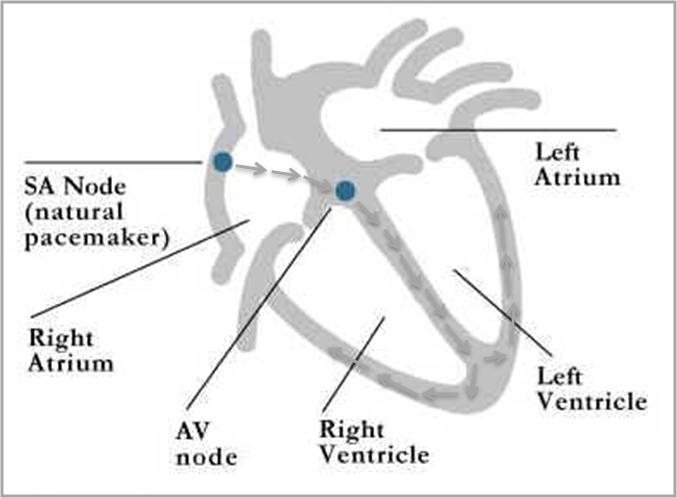 Supraventricular Tachycardia